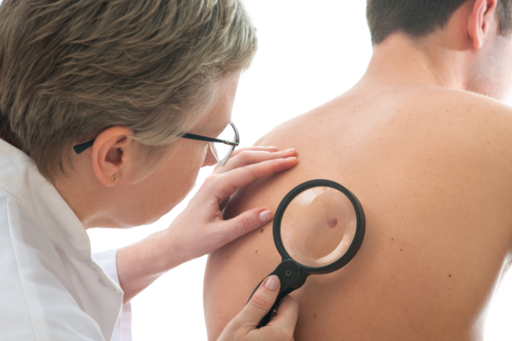 Imagen destacada - Dermatologia aplicada a la cirugía menor
