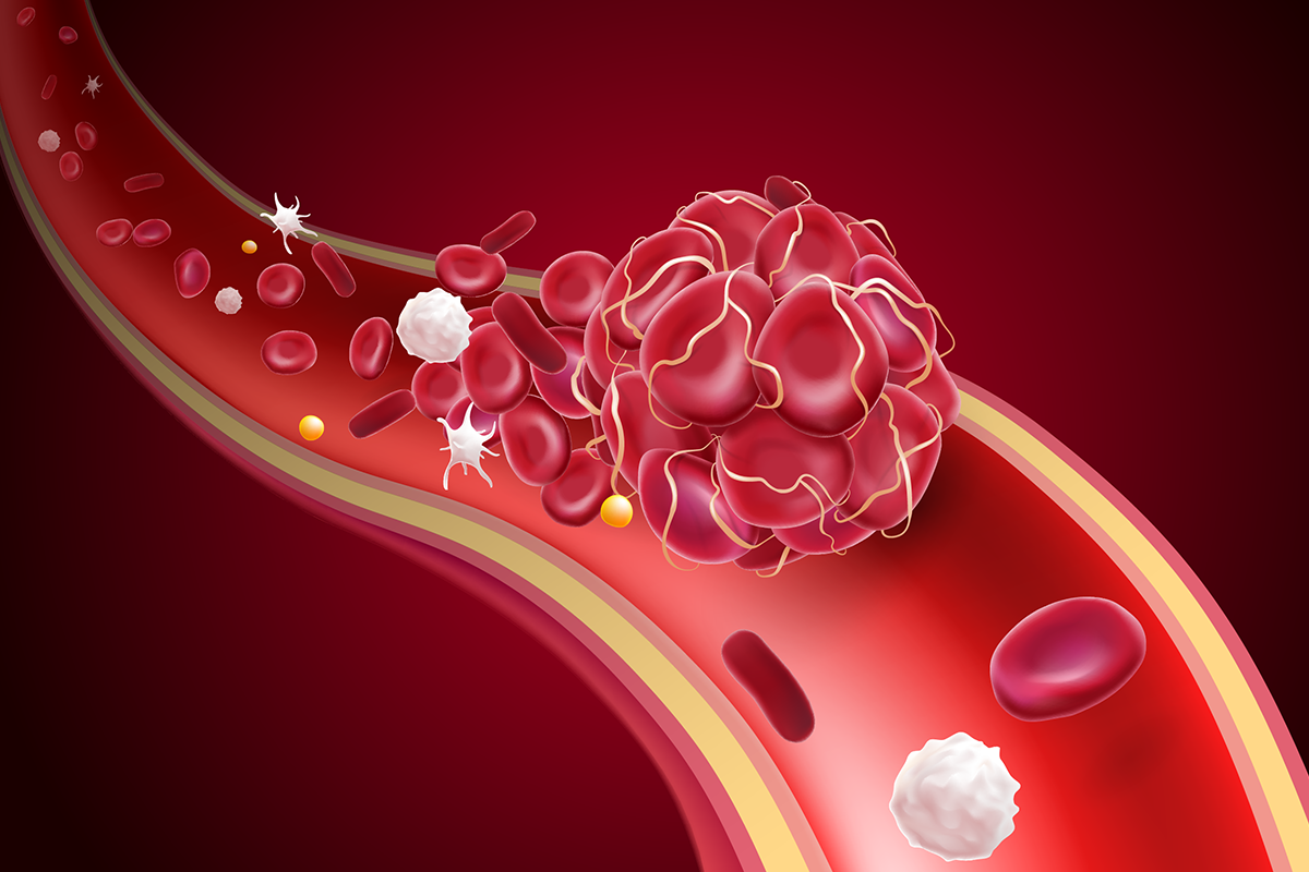 Imagen destacada - Anticoagulantes orales directos (ACOD)