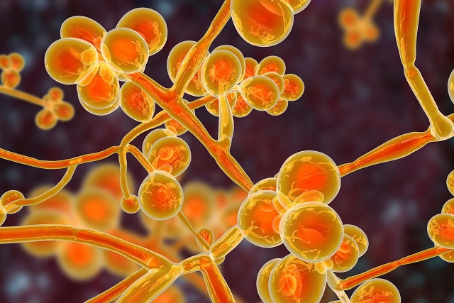 Imagen destacada - Candidiasis o Micosis vaginal.