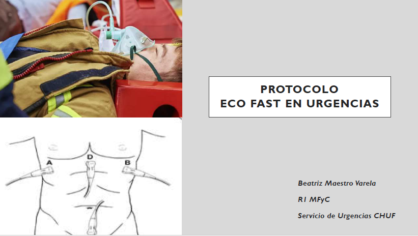 Imagen destacada - Eco FAST y eFAST