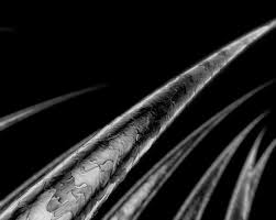 Imagen destacada - Alopecia. Tratamiento