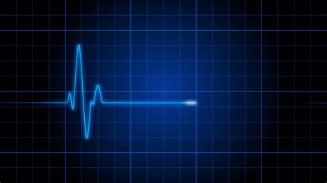 Imagen destacada - Ekg. Imágenes para el diagnóstico