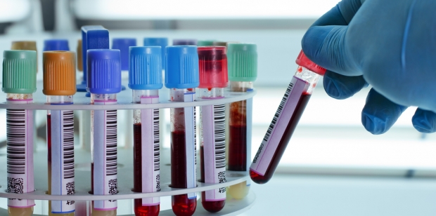 Imagen destacada - Hepatitis B. Perfiles serológicos de la infección 
