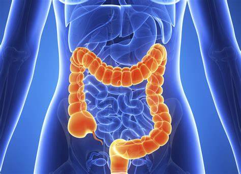 Imagen destacada - Lesiones polipósicas en cáncer de colon. Control