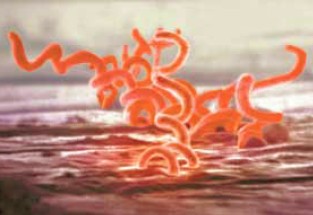 Imagen destacada - Sífilis