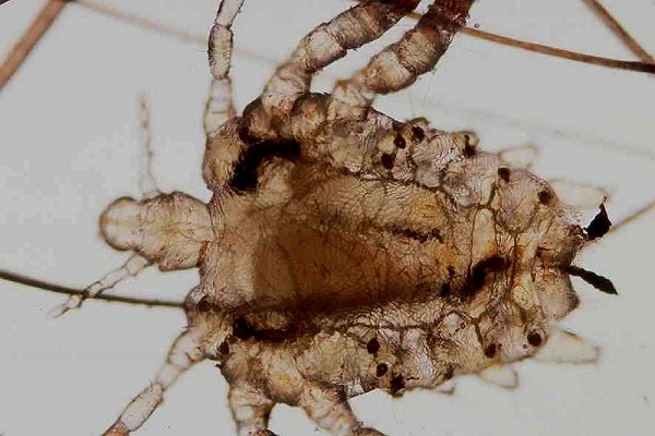 Imagen destacada - Pediculosis pubis