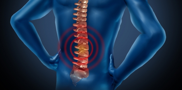 Imagen destacada - ¿Cómo tratar una fractura vertebral aguda en el osteoporótico?