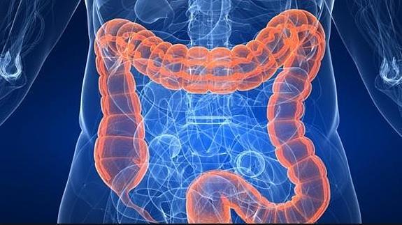 Imagen destacada - Colonoscopia. Criterios petición en familiares de cáncer colorrectal