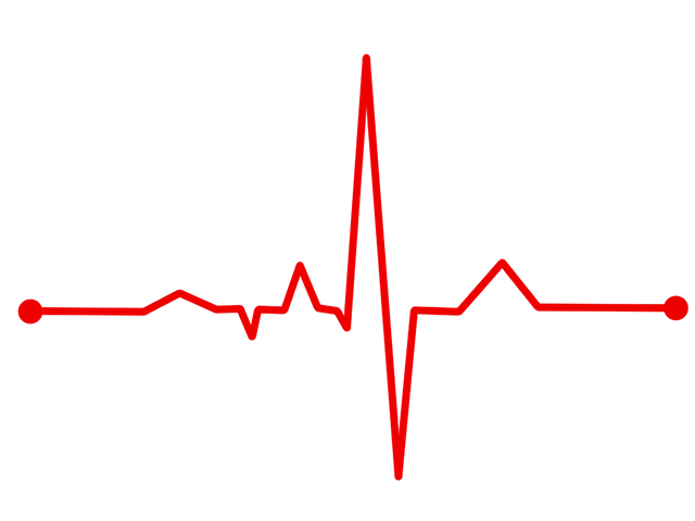 Imagen destacada - EKG. Cardiología