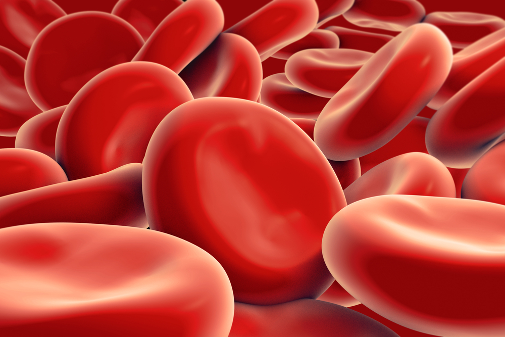 Imagen destacada - Anemia megaloblástica